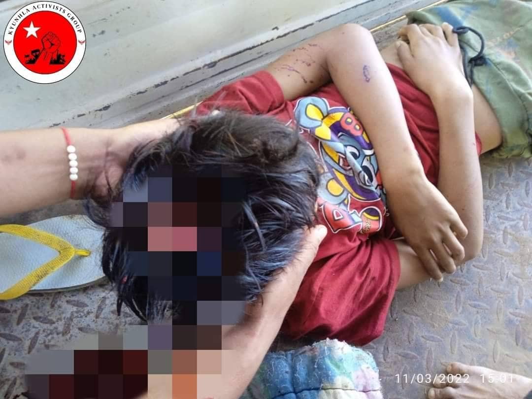 ကန့်ဘလူမြို့နယ်တွင် စစ်ကောင်စီ၏ လက်နက်ကြီးပစ်ခတ်မူကြောင့် ကလေးငယ်တစ်ဦးသေဆုံး၊၃ဦးဒဏ်ရာရ