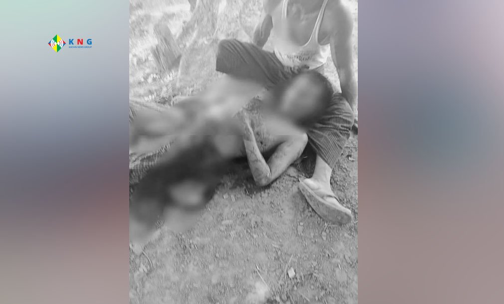 ဓာတ်ပုံ-ဇူလိုင်၁၆ရက်နေ့ လက်နက်ကြီးထိမှန်ခဲ့ရတဲ့ဒေသခံနှစ်ဦး