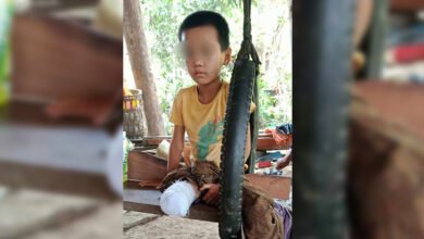 ပြီးခဲ့တဲ့ မေလ၂၇ရက်နေ့ လက်နက်ကြီးထိမှန်မူကြောင့် ခြေထောက်ဖြတ်လိုက်ရတဲ့ကလေးငယ်